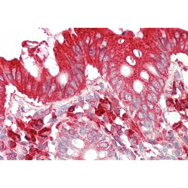 Immunohistochemistry - Anti-TFB2M Antibody (A83881) - Antibodies.com