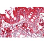 Immunohistochemistry - Anti-TFB2M Antibody (A83881) - Antibodies.com