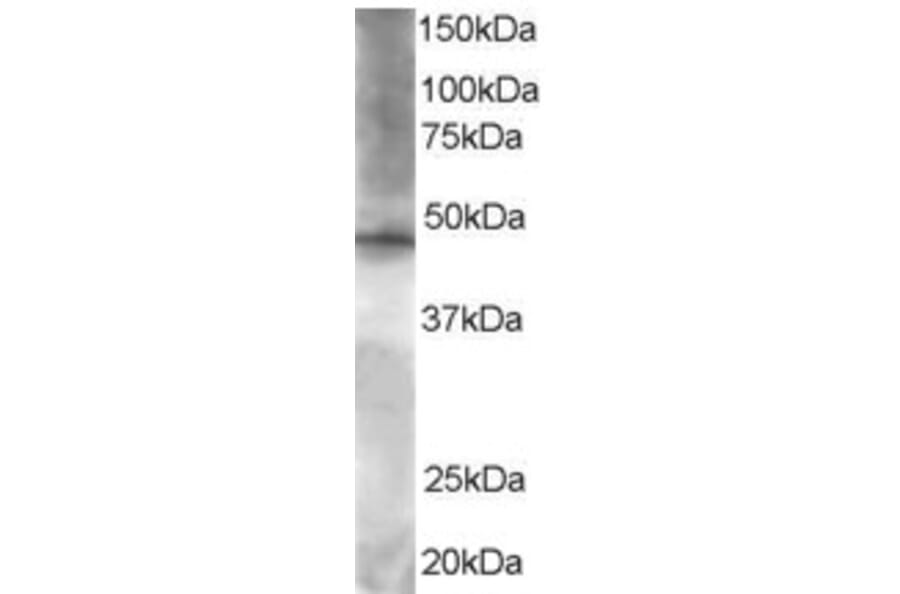 Western Blot - Anti-BRF2 Antibody (A83882) - Antibodies.com