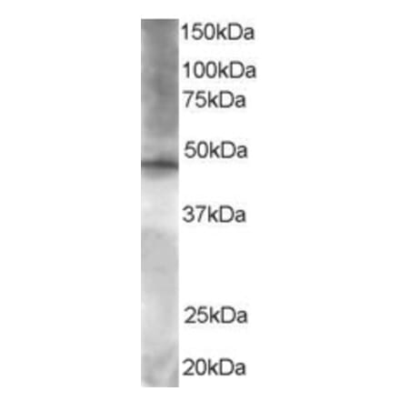 Western Blot - Anti-BRF2 Antibody (A83882) - Antibodies.com