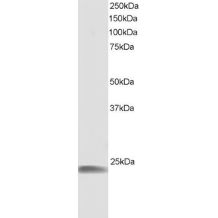 Western Blot - Anti-Hsp22/HSPB8 Antibody (A83884) - Antibodies.com