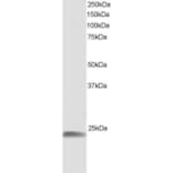 Western Blot - Anti-Hsp22/HSPB8 Antibody (A83884) - Antibodies.com