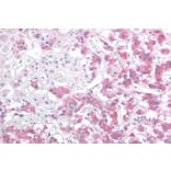 Immunohistochemistry - Anti-Hsp22/HSPB8 Antibody (A83884) - Antibodies.com