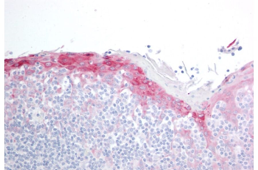 Immunohistochemistry - Anti-Hsp22/HSPB8 Antibody (A83884) - Antibodies.com