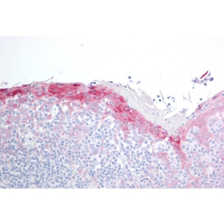 Immunohistochemistry - Anti-Hsp22/HSPB8 Antibody (A83884) - Antibodies.com