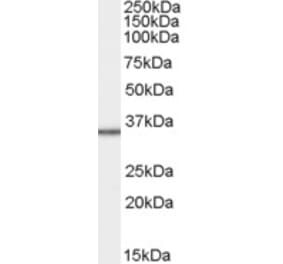 Western Blot - Anti-MRPL3 Antibody (A83885) - Antibodies.com