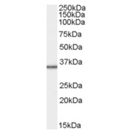 Western Blot - Anti-MRPL3 Antibody (A83885) - Antibodies.com