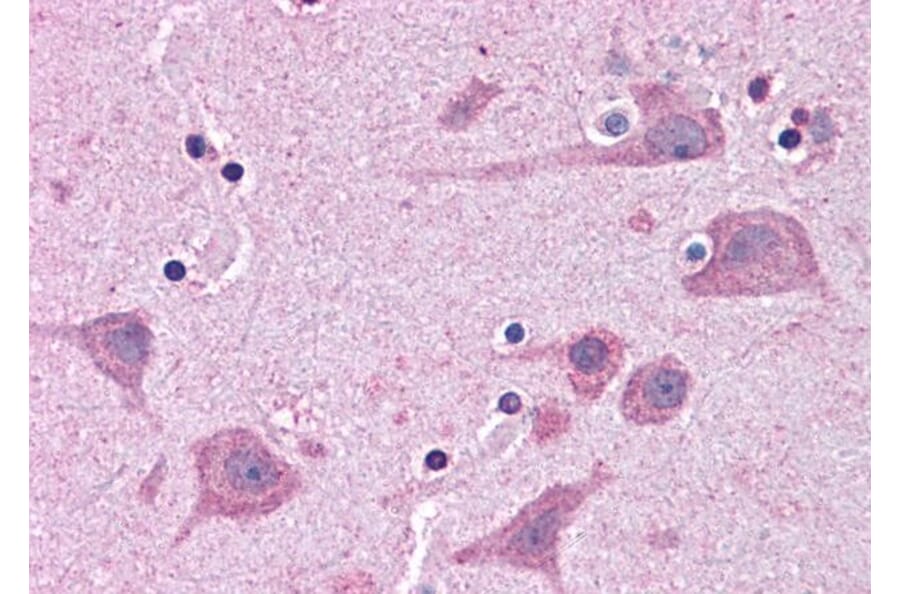 Immunohistochemistry - Anti-Tankyrase Binding Protein 1 Antibody (A83886) - Antibodies.com