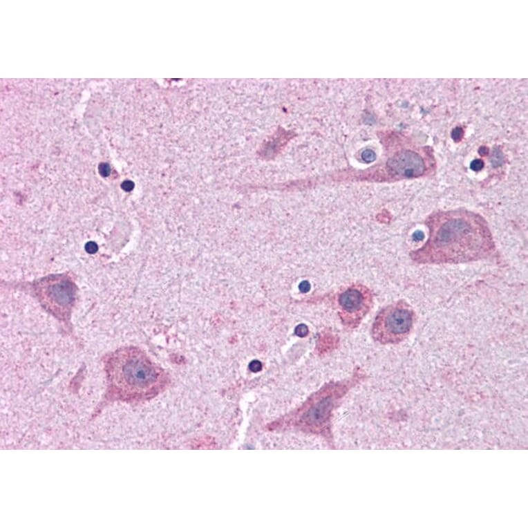 Immunohistochemistry - Anti-Tankyrase Binding Protein 1 Antibody (A83886) - Antibodies.com