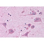 Immunohistochemistry - Anti-Tankyrase Binding Protein 1 Antibody (A83886) - Antibodies.com