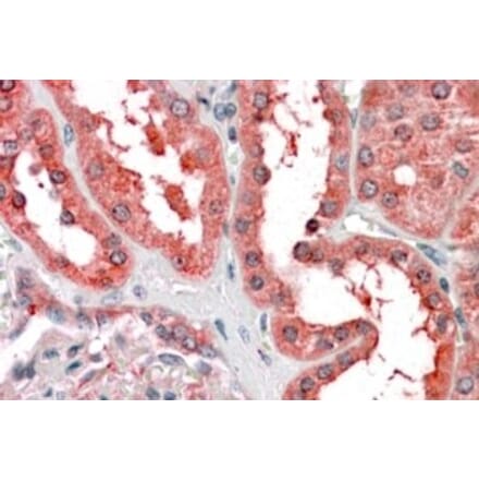 Immunohistochemistry - Anti-Cyt 19 Antibody (A83887) - Antibodies.com