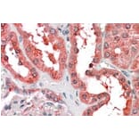 Immunohistochemistry - Anti-Cyt 19 Antibody (A83887) - Antibodies.com