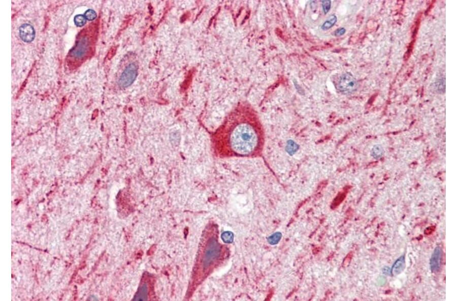 Immunohistochemistry - Anti-PRDM11 Antibody (A83888) - Antibodies.com