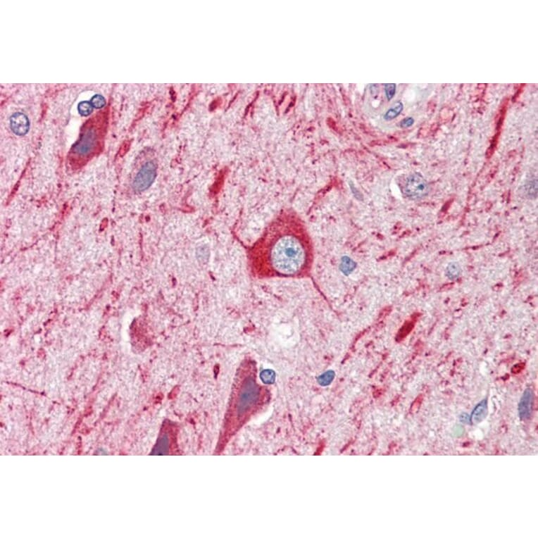 Immunohistochemistry - Anti-PRDM11 Antibody (A83888) - Antibodies.com