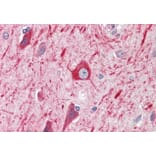 Immunohistochemistry - Anti-PRDM11 Antibody (A83888) - Antibodies.com