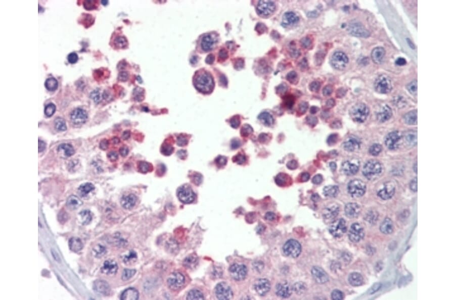 Immunohistochemistry - Anti-KMT2B/MLL4 Antibody (A83890) - Antibodies.com
