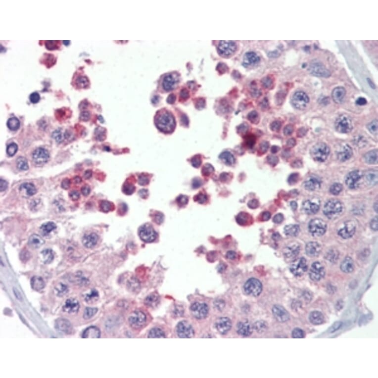 Immunohistochemistry - Anti-KMT2B/MLL4 Antibody (A83890) - Antibodies.com