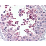 Immunohistochemistry - Anti-KMT2B/MLL4 Antibody (A83890) - Antibodies.com