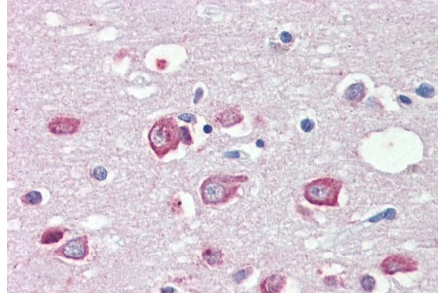 Immunohistochemistry - Anti-KMT2B/MLL4 Antibody (A83890) - Antibodies.com