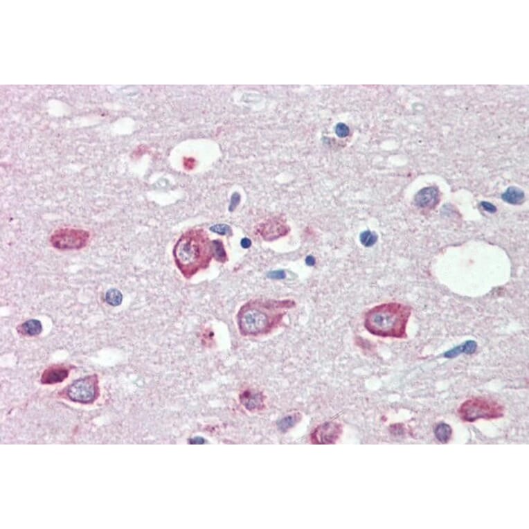 Immunohistochemistry - Anti-KMT2B/MLL4 Antibody (A83890) - Antibodies.com