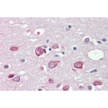 Immunohistochemistry - Anti-KMT2B/MLL4 Antibody (A83890) - Antibodies.com