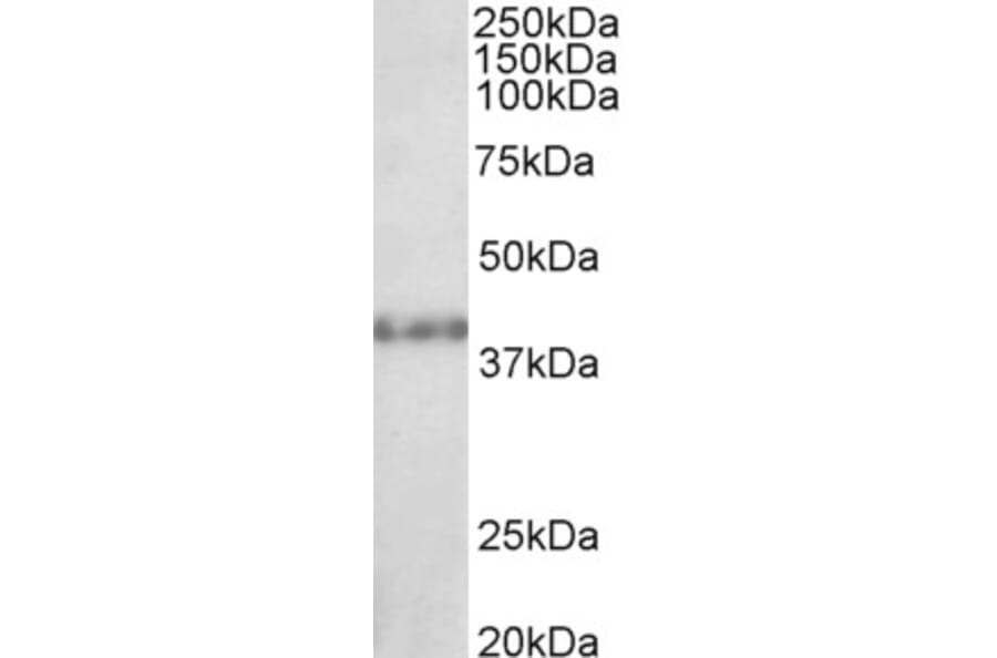 Western Blot - Anti-KMT1B/SUV39H2 Antibody (A83891) - Antibodies.com