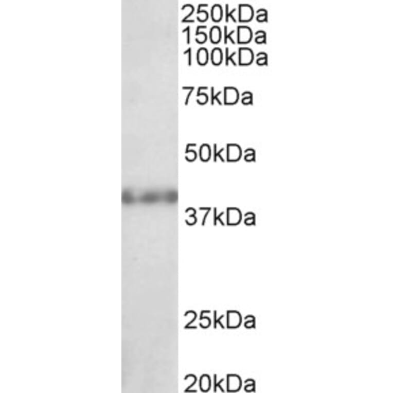 Western Blot - Anti-KMT1B/SUV39H2 Antibody (A83891) - Antibodies.com