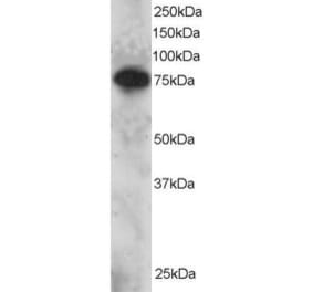 Western Blot - Anti-Metnase Antibody (A83892) - Antibodies.com