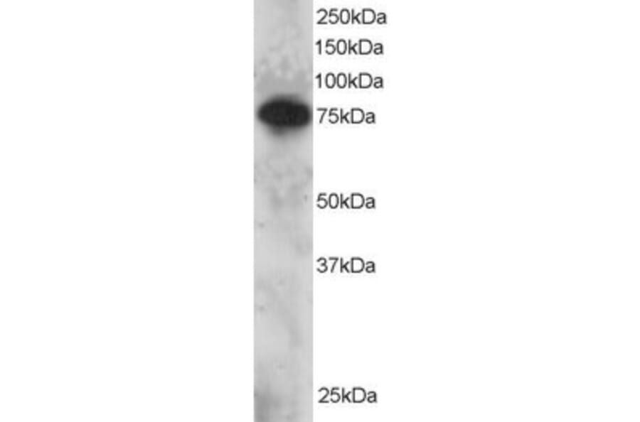 Western Blot - Anti-Metnase Antibody (A83892) - Antibodies.com