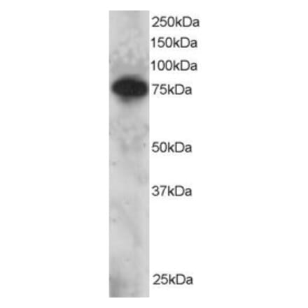 Western Blot - Anti-Metnase Antibody (A83892) - Antibodies.com