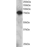 Western Blot - Anti-Metnase Antibody (A83892) - Antibodies.com