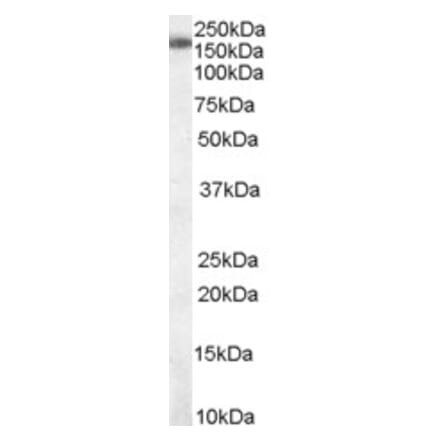 Western Blot - Anti-SART3 Antibody (A83894) - Antibodies.com