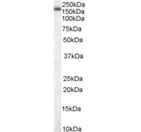 Western Blot - Anti-SART3 Antibody (A83894) - Antibodies.com