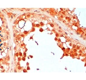 Immunohistochemistry - Anti-UBC3B Antibody (A83895) - Antibodies.com