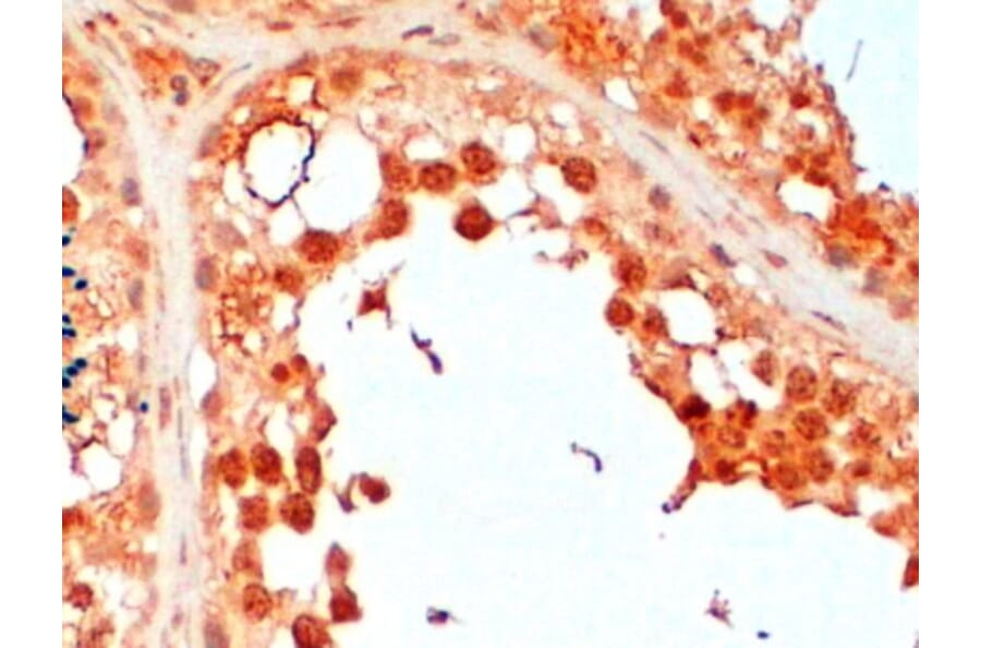 Immunohistochemistry - Anti-UBC3B Antibody (A83895) - Antibodies.com