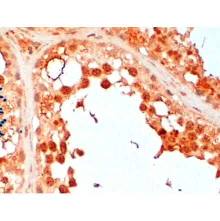 Immunohistochemistry - Anti-UBC3B Antibody (A83895) - Antibodies.com