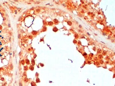 Anti-UBE2R2 Antibody (A83895) (2µg/ml) staining of paraffin embedded Human Testis. Steamed antigen retrieval with citrate buffer pH 6, HRP-staining.