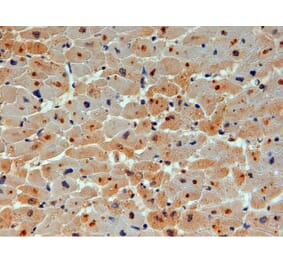 Immunohistochemistry - Anti-UBE2O Antibody (A83897) - Antibodies.com