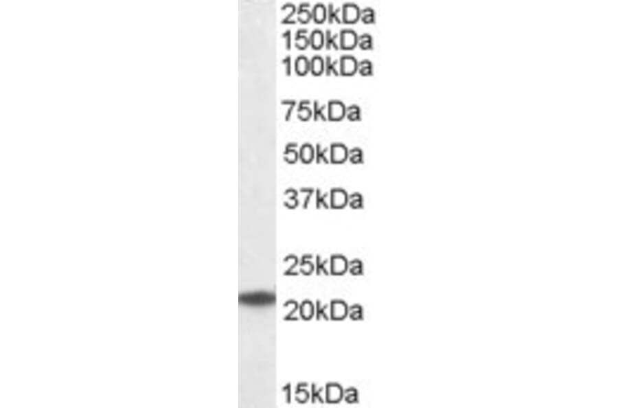 Western Blot - Anti-HSPC150/UBE2T Antibody (A83898) - Antibodies.com
