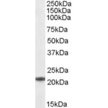 Western Blot - Anti-HSPC150/UBE2T Antibody (A83898) - Antibodies.com