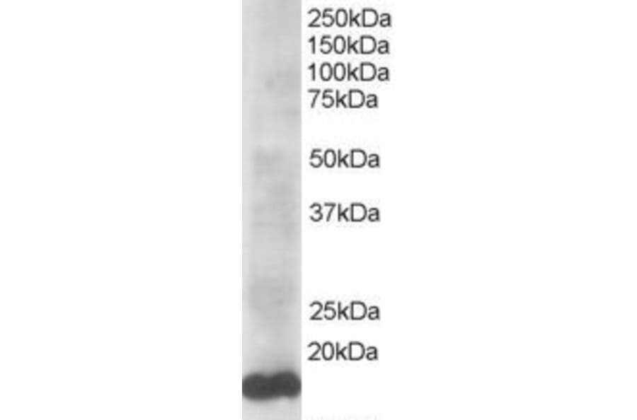 Western Blot - Anti-Ube2L3 Antibody (A83899) - Antibodies.com