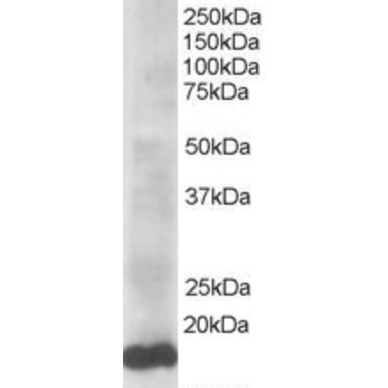 Western Blot - Anti-Ube2L3 Antibody (A83899) - Antibodies.com