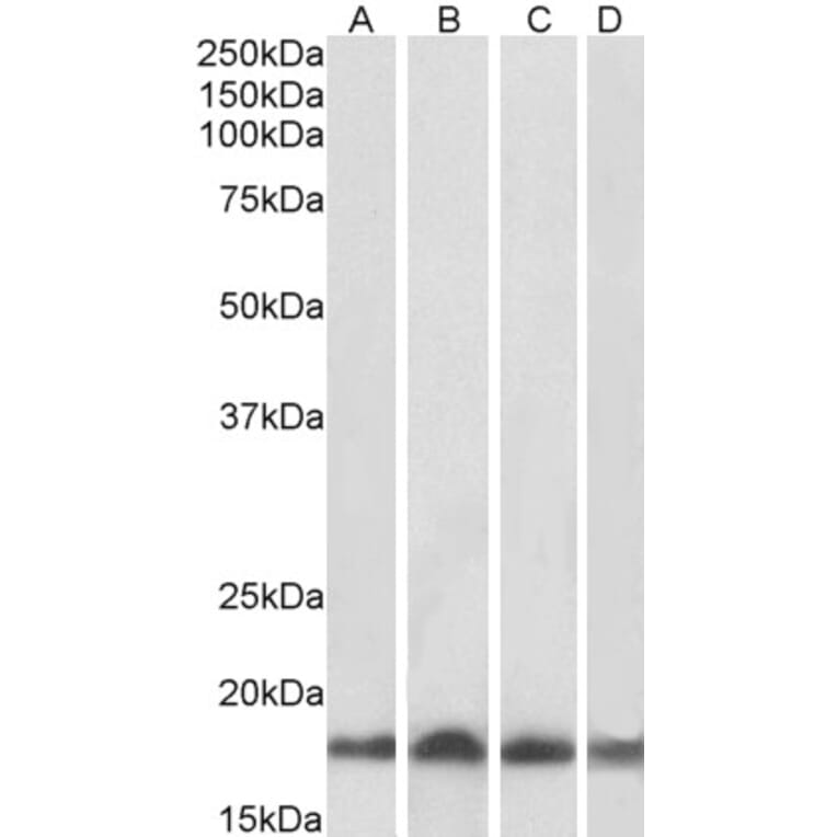 Western Blot - Anti-Ube2L3 Antibody (A83899) - Antibodies.com