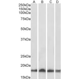 Western Blot - Anti-Ube2L3 Antibody (A83899) - Antibodies.com