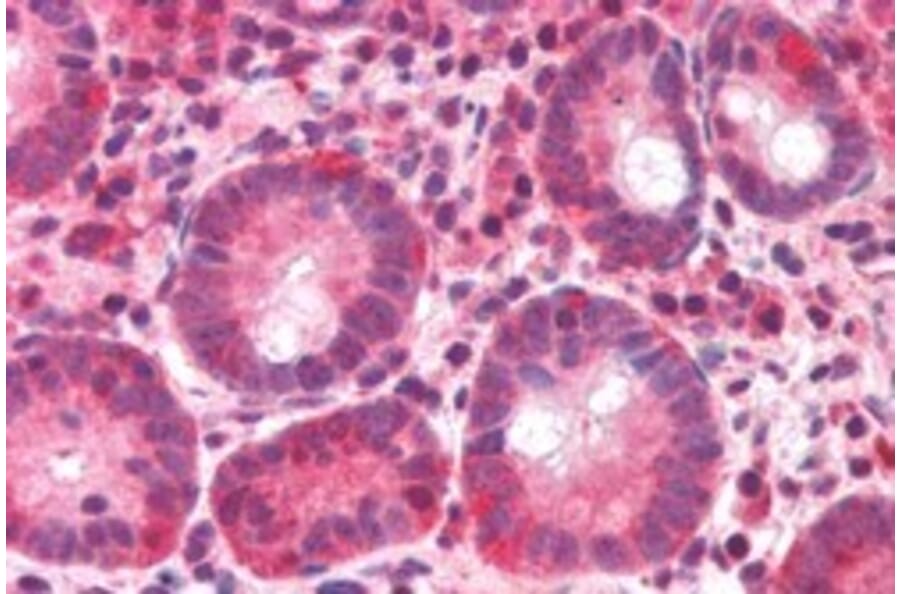 Immunohistochemistry - Anti-BAZ2B Antibody (A83900) - Antibodies.com