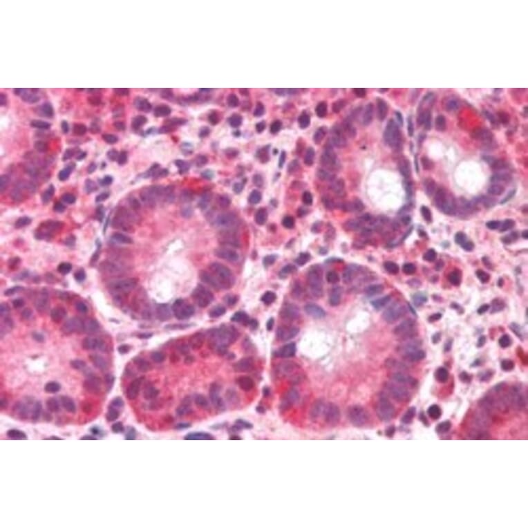 Immunohistochemistry - Anti-BAZ2B Antibody (A83900) - Antibodies.com