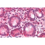 Immunohistochemistry - Anti-BAZ2B Antibody (A83900) - Antibodies.com