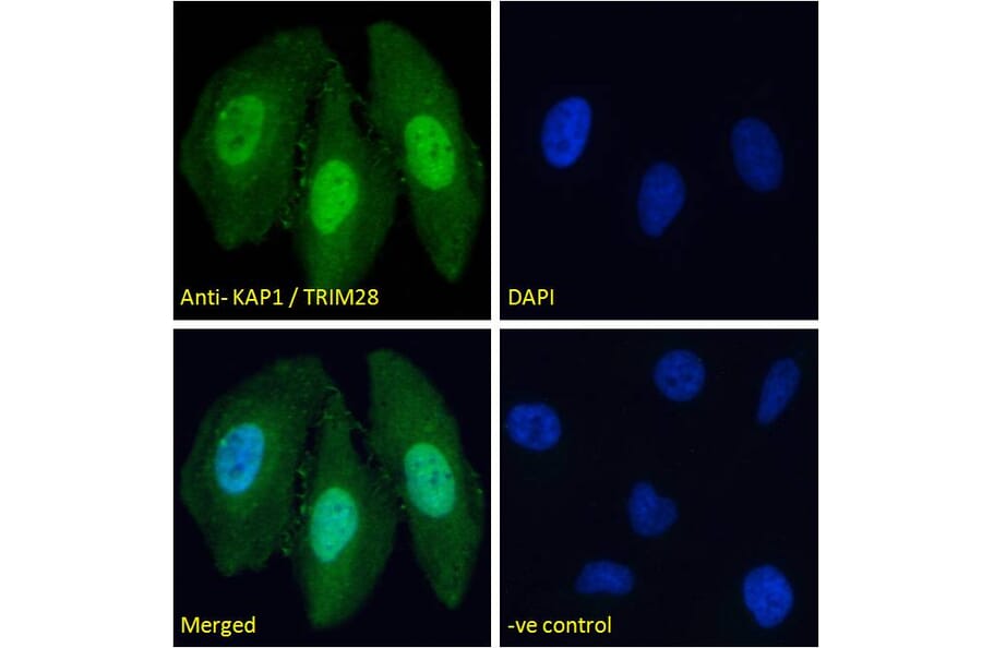 Immunofluorescence - Anti-KAP1 Antibody (A83901) - Antibodies.com