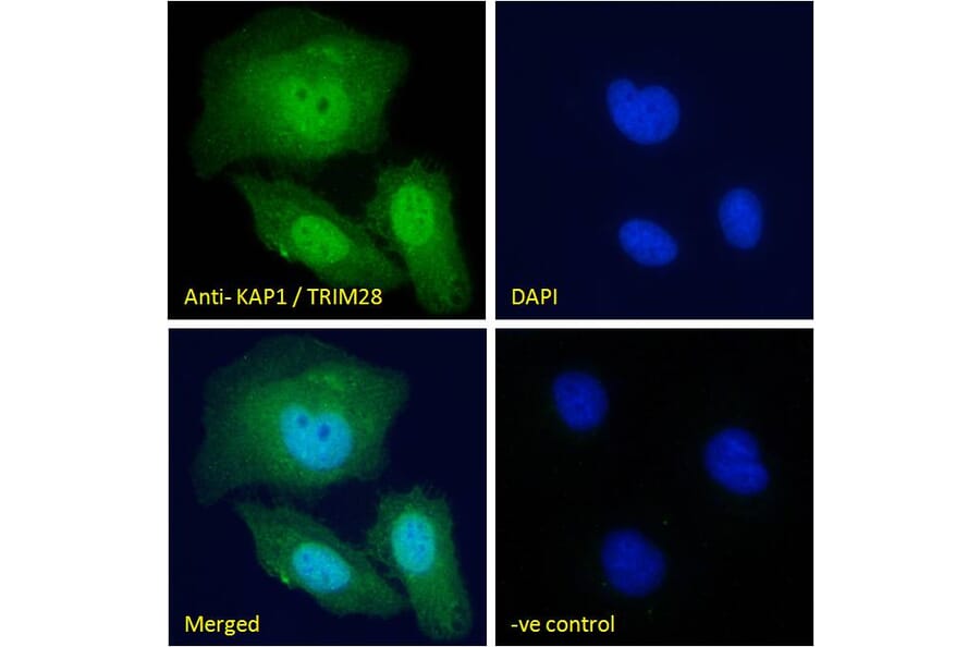 Immunofluorescence - Anti-KAP1 Antibody (A83901) - Antibodies.com