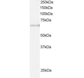 Western Blot - Anti-ARIH1 Antibody (A83902) - Antibodies.com